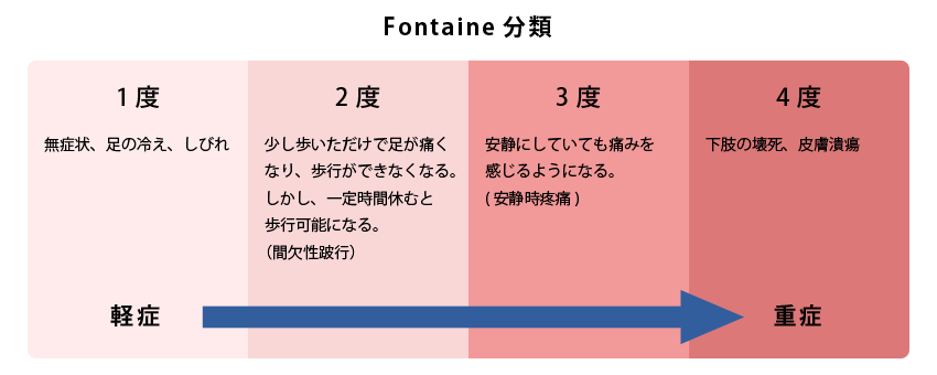fig11 Fontaine分類